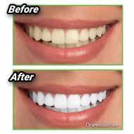Miracle Teeth - węgiel na wybielanie zębów